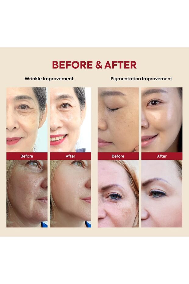 https://cdn.dsmcdn.com/mnresize/620/920/ty1799/prod/QC_PREP/20251210/19/ab541228-5b03-3948-aca4-5d7dac77b031/1_org_zoom.jpg