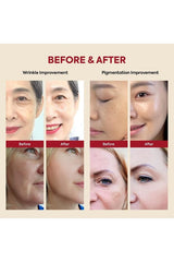 https://cdn.dsmcdn.com/mnresize/620/920/ty1799/prod/QC_PREP/20251210/19/ab541228-5b03-3948-aca4-5d7dac77b031/1_org_zoom.jpg
