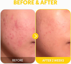 TIRTIR Pure Vitamin C 24% Face Serum – Dark Spot Remover for Sensitive Skin with Collagen Anti Aging Even out Skin Tone Non irritation tested, Wrkinkles, Korean Mild Vita C Facial Serum 1.01 Fl Oz