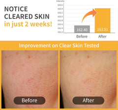 numbuzin No.5 Vitamin-Niacinamide Concentrated Pad, Daily Double-Sided Facial Pads with Glutathione, PHA & LHA for a Fresh, Radiant-Looking Skin Finish 180 ml (70 Pads)