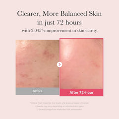 medicube TXA+Niacinamide 15% Glow Facial Seurm for After Spot Care | All-in-One Daily Korean Skincare | Uneven Skin Tone, Texture, and Hydration Care | High-Potency Tranexamic Acid 5% | 1.01 fl.oz