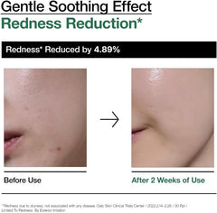 Anua PDRN Hyaluronic Acid Capsule 100 Serum, Radiant Face Serum, Hyaluronic Acid, Hydration, Moisture Plumping effect, Natural color, Fragrance free, Korean Skincare, 30ml / 1.01 fl. oz (Peach)