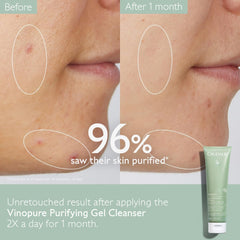 Caudalie Vinopure Purifying Gel Cleanser 150 Milliliters / 5 Ounce