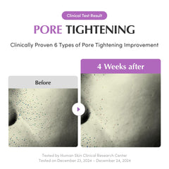 EQQUALBERRY Purple PDRN Pore Minimizing Serum – Vegan Collagen & Peptides for Pore Refining & Skin Elasticity | Niacinamide & CICA Exosome for Calming | Korean Glass Skin, 1.01 FL OZ