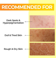 numbuzin No.5 Toner | Vitamin Boosting Essential Toner | First Step Skin Care | Improves Hyperpigmentation and Uneven Skin Tone | 6.76 fl. oz.