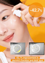 celimax Pore+Dark Spot Brightening Serum 30ml | Gel-like Serum for Enlarged Pores with Niacinamide, Tranexamic Acid, Pore Minimizer, Non-Irritating, Hydrating, For Sensitive Skin, hyperpigmentation