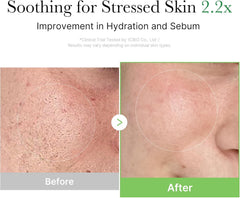 medicube Exosome Cica Tea Tree Cream for Sensitive Skin with Centella Asiatica help reduce redness and breakouts. | Low-irritating, Moisturizing Daily Texture Care | Korean Skincare | 1.7 fl oz