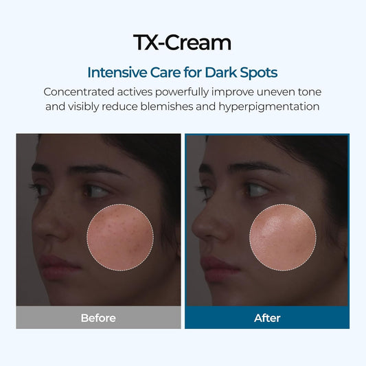 DR.Melaxin TX Tranexamic Acid CREAM | Skin freckle Cream, Blemishes, Anti-pigmetation korean skin care | Korean Cosmetics | 1.7 fl oz (50 ml)