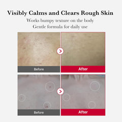 medicube Red Body Peeling Shot, Strawberry Skin Body Spray Cleanser, AHA + BHA + Succinic Acid, Exfoliating, 3.88 oz.