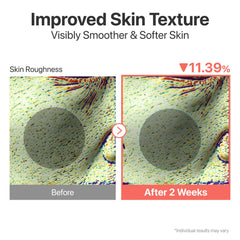 numbuzin No.3 Skin Softening Serum, Fermented Serum for Skin Texture & Pores, Bifida & Galactomyces, Niacinamide, Adenosine, Panthenol, Fragrance-Free, 1.69 fl oz (50ml)