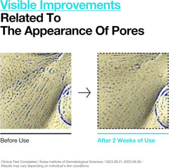 ANUA BHA 2% Gentle Exfoliating Toner, Mild Facial Exfoliant, Salicylic Acid for Pores and Sebum, Teatree Extract, Hyaluronic Acid, Ceramides (150ml / 5.07 fl.oz.)