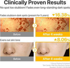 numbuzin No.5 Serum | Glutathione TXA Advanced Dark Spot Ampoule Concentrate | Tranexamic Acid, Niacinamide | Hyperpigmentation| Suitable for Sensitive Skin, Korean Skincare | 10.7g