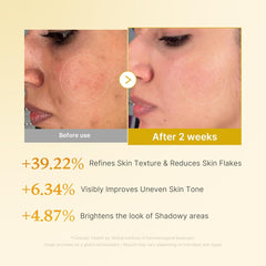 medicube Kojic Acid Turmeric Smoothing Toner for Face & Body | Lightweight Toner for Balancing Uneven Skin Tone & Texture | Niacinamide, Glycolic Acid for Clear Glass Skin | 8.45 fl.oz