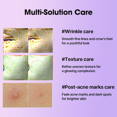 SOME BY MI Retinol Intense Reactivating Serum – 1.01oz, 30ml – Korean Bakuchiol Retinol Serum for Face Firming – Improves Signs of Aging, Minimizes Pore Size & Refines Skin Texture – Korean Skin Care