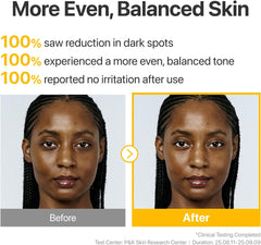 numbuzin No.5 Serum | Glutathione TXA Advanced Dark Spot Ampoule Concentrate | Tranexamic Acid, Niacinamide | Hyperpigmentation| Suitable for Sensitive Skin, Korean Skincare | 10.7g