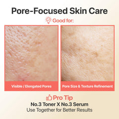 numbuzin No.3 Skin Softening Serum, Fermented Serum for Skin Texture & Pores, Bifida & Galactomyces, Niacinamide, Adenosine, Panthenol, Fragrance-Free, 1.69 fl oz (50ml)