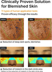 celimax Pore + Dark Spot Brightening Cream