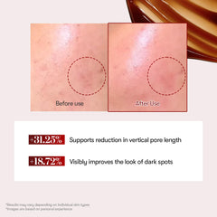 VT COSMETICS Reti-A Reedle Shot 100 Serum with Retinol (Vitamin A) & Repairing Exosome Microneedling Formula, Korean Skin Booster, 1.69 fl oz(50ml)