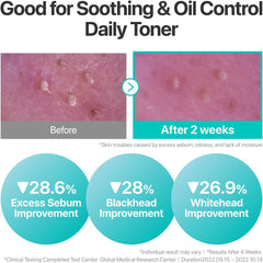 numbuzin No.1 Toner | Pure-Full Calming Herb Toner | Breakouts, Redness, Excess Oil Control, Blackhead Removal | Centella Asiatica, Heartleaf, Licorice Root | Acne-Prone, Sensitive Skin | 300ml