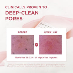 SKIN1004 Poremizing Deep Cleansing Foam, 4.23 fl.oz, 125ml, Makeup Remover, Korean Face Cleanser with Himalayan Pink Salt & Madagascar Centella Asiatica for Facial Pore Cleansing, Korean Skin Care