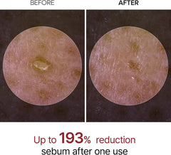 Dr.Melaxin Peel Shot Glow Black Rice Peeling Ampoule, Soft Exfoliating Face and Body Scrub Dead Skin Cells, Blackheads Remover for All Skin Types, 80ml