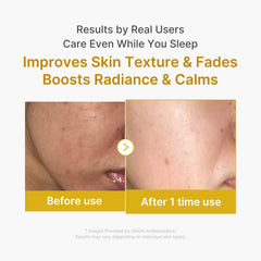 medicube Wrapping Mask PDRN Caffeine Overnight Peel Off Facial Mask | Firming, Depuffing & Hydration | Caffeine, Collagen For Refined, Glass Skin & Face Contour Support | Korean Skin Care, 2.53 fl.oz