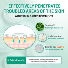 SOME BY MI Micro Pin Spot Patch - Pack of 1, 14mm 9 Counts - Microneedle Hydrocolloid Pimple Patch with Salicylic and Hyaluronic Acid - Skin Troubles Care Focused Spot Cover - Korean Skin Care