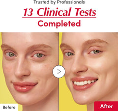 EQQUALBERRY Vitamin Illuminating Serum – Brightening Vitamin C Serum with Niacinamide | Strengthens skin barrier | Hydrates using Ceramide and Hyaluronic Acid, 1.01oz / 30ml