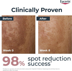 Eucerin Even Pigment Perfector Dual Face Serum Cream, Reduces Pigment Spots, Plumps up Wrinkles, Refines Skin Texture, Suitable for All Skin Types, 30ml