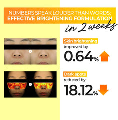 numbuzin No.5 Toner | Vitamin Boosting Essential Toner | First Step Skin Care | Improves Hyperpigmentation and Uneven Skin Tone | 6.76 fl. oz.