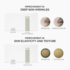 SKIN1004 Retinol 0.2% Boosting Shot Ampoule 1.01fl.oz, 30ml, Hydrating Face Serum, Concentrated Korean Facial Spicule Serum, Retinol & Retinal, Madagascar Centella Asiatica Extract, Korean Skin Care