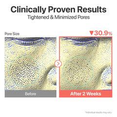 numbuzin No.3 Skin Softening Serum, Fermented Serum for Skin Texture & Pores, Bifida & Galactomyces, Niacinamide, Adenosine, Panthenol, Fragrance-Free, 1.69 fl oz (50ml)