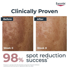Even Pigment Perfector Night Cream 50 ml