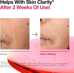 ANUA NIACINAMIDE10% + TXA 4% DARK SPOT REMOVING SERUM 30mL