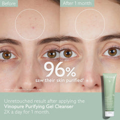 Caudalie Vinopure Purifying Gel Cleanser 150 Milliliters / 5 Ounce