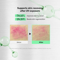 VT COSMETICS CICA Reedle Shot 100, Spicule Microneedling Serum for Pore Care & Exfoliation, Exosome, Centella Asiatica for Glass Skin, Skin Texture, Korean Liquid Skin Booster (1.69 Fl Oz / 50ml)