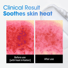 SOME BY MI Beta-Panthenol Repair Cream – 1.69oz, 50ml – Hydrating Face Moisturizer with Panthenol & Redness Relief – Skin Barrier Repair & Soothing Face Cream with Beta-Sitosterol – Korean Skin Care