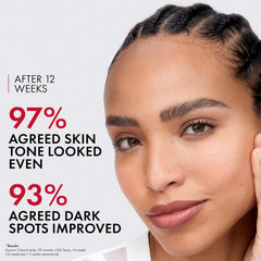 Vichy LiftActiv B3 Serum 5% Niacinamide + Glycolic Acid + Tranexamic Acid + Peptides, Fades Dark Spots & Smooths Wrinkles In 8 Weeks, Discoloration Correcting Serum, Alcohol Free