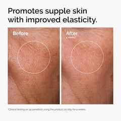 The Ordinary Bright & Hydrated Duo Skincare Set – AHA 30% + BHA 2% Peeling Solution & Hyaluronic Acid 2% + B5 – Exfoliates, Hydrates & Targets Blemishes – 1 Fl Oz Each, Vegan & Cruelty-Free