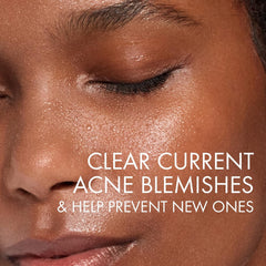 VICHY Normaderm Daily Acne Face Wash, Salicylic Acid Face Cleanser for Oily & Acne Prone Skin, Acne Cleanser that Clears Clogged Pores and Blackhead